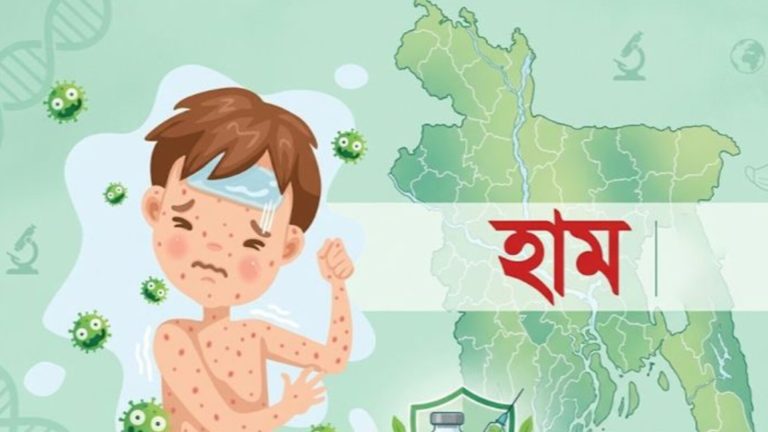 হামের উপসর্গে আরও ৪ জনের মৃত্যু, নতুন শনাক্ত ১১৬০